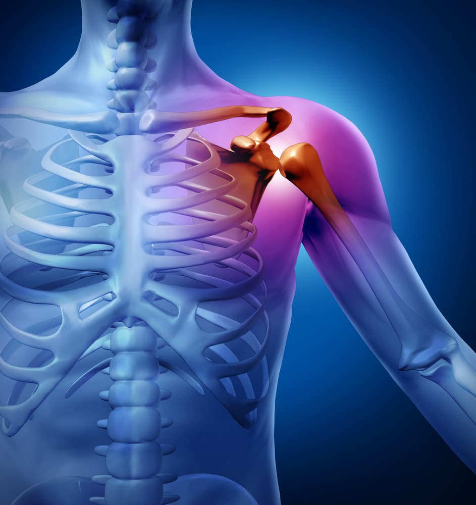 sciatica back pain, disc problems, neck pain, shoulder pain, sports